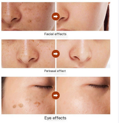Astragalus Herbal Spot-Correcting Cream