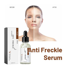 Hoygi Niacinamide Skin Radiance Serum