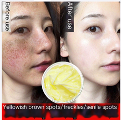 Astragalus Herbal Spot-Correcting Cream